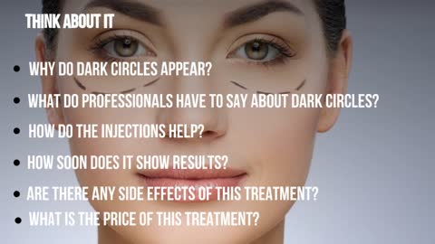 Dark Circles: How to Get Rid of Dark Circle