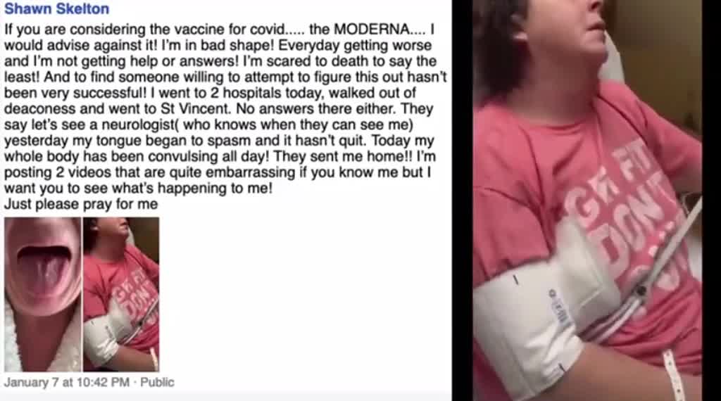 Shawn Skelton Bizarre Side Effects COVID-19 Moderna Vaccine,