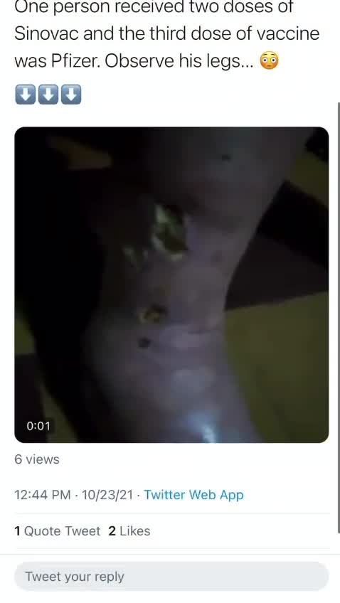 A terrible reaction to the Pfizer ‘vaccine’