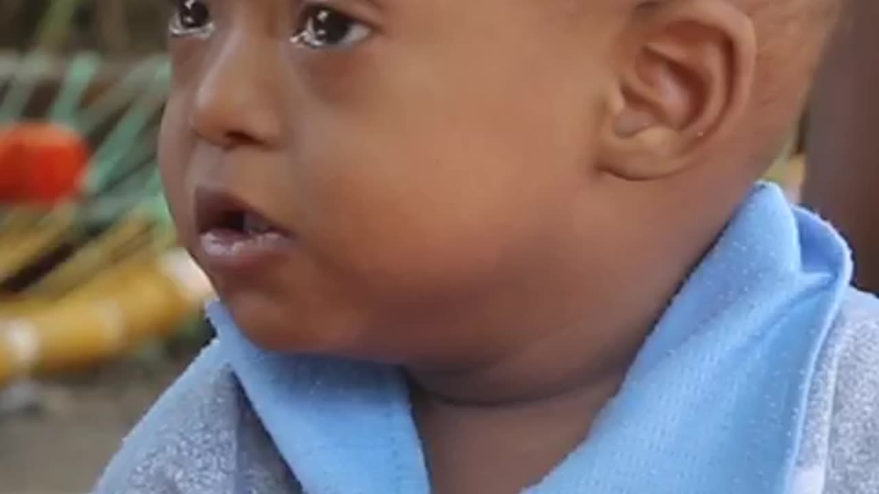 What is Mpox? Understanding Its Spread to Children and UNICEF's Actions