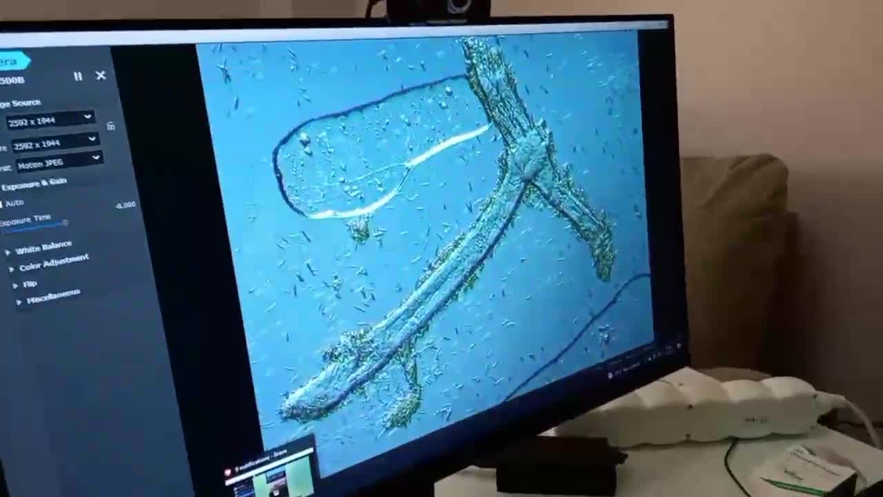 Graphene in Local anesthetic - Bupivacaine