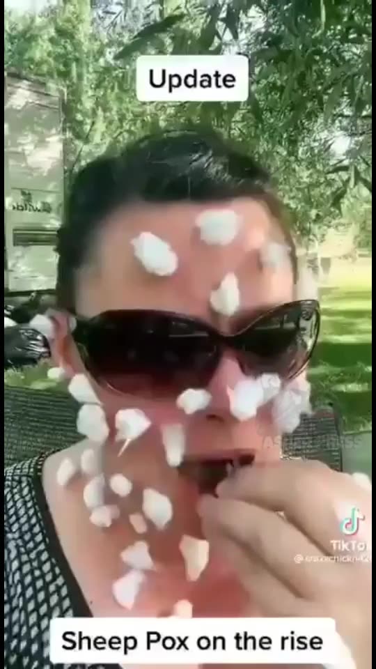 Sheep Pox is on the rise! This is Baaad