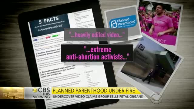 Planned Parenthood Doctor Admits To Selling Aborted Baby Body Parts.