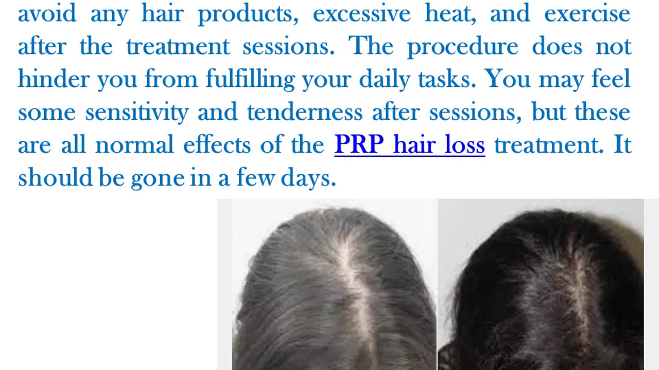 Effective PRP Treatment for Hair Loss in NYC