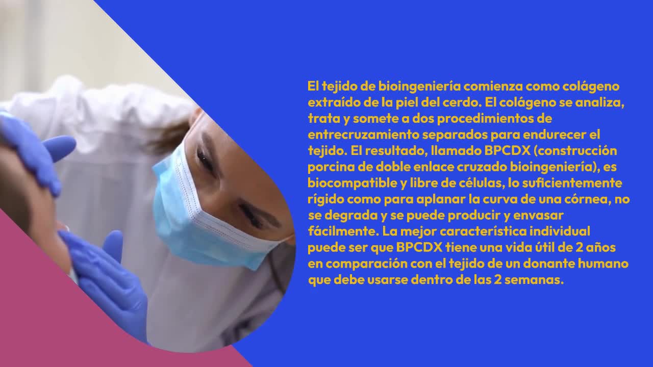 ¿Cuáles son los beneficios del tratamiento del queratocono? | Fernandez Velazquez