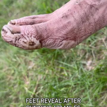 Why You Must Change Socks During a Marathon – Shocking 100 Mile Foot Reveal!