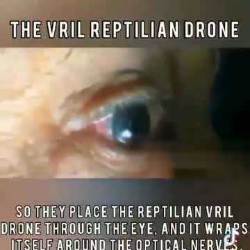 REPTILLIAN VRIL TAKEN OUT OF EYE - DIFFICULT TO WATCH
