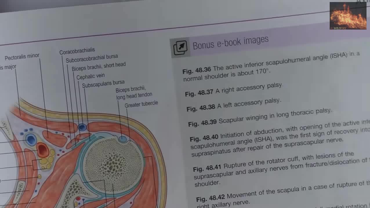 DR. CAMPBELL WHAT'S CAUSING BLOOD CLOTS