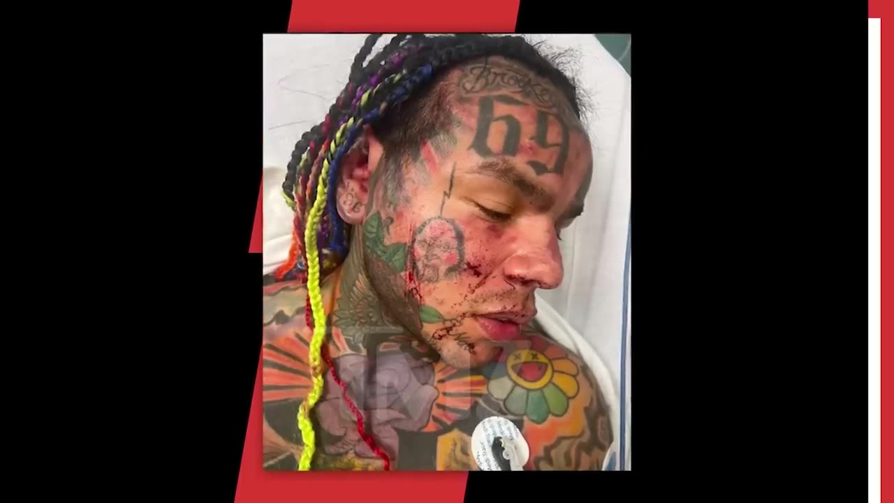 6ix9ine Hospitalized After BRUTAL Beatdown At Florida Gym 😳