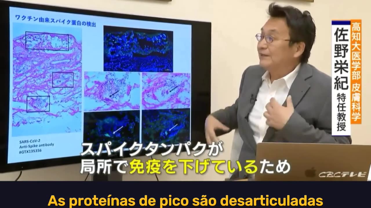 O Japão fala sobre as Reações Adversas Graves das vacinas de mRNA.