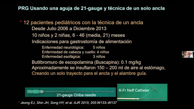 No. 16- Gastrosotmia, Gastroyeyunostomia y Yeyunostomia Percutánea Radiológica