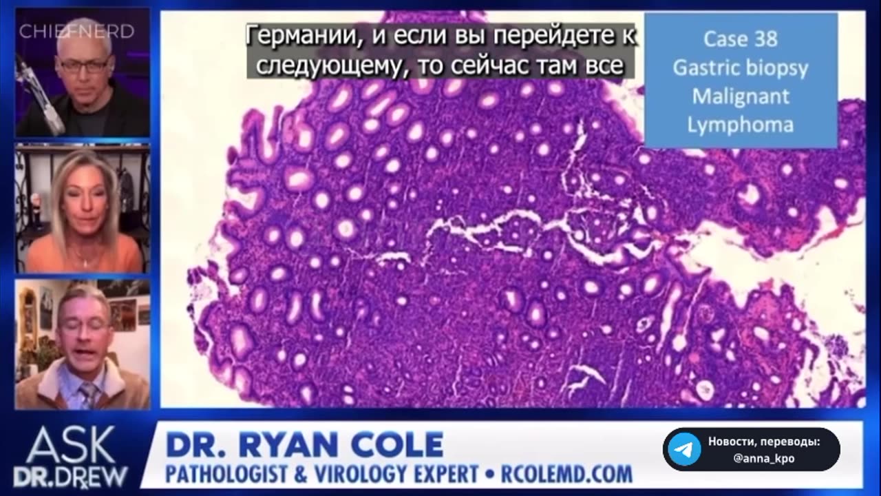 Dr. Ryan Cole shares horrific biopsy results