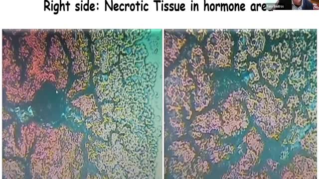 Spike Protein and Graphene Oxide Blood Effects - Is there a solution ?