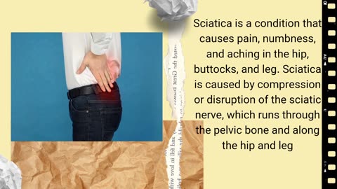 Sciatica