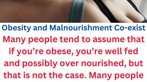 obesity facts....4/14