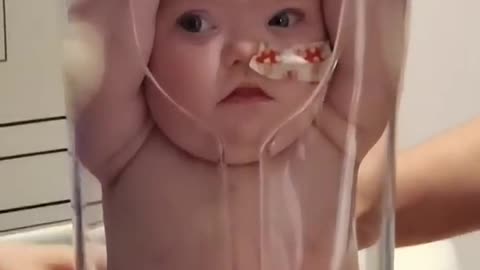 How Baby Get An X-Ray