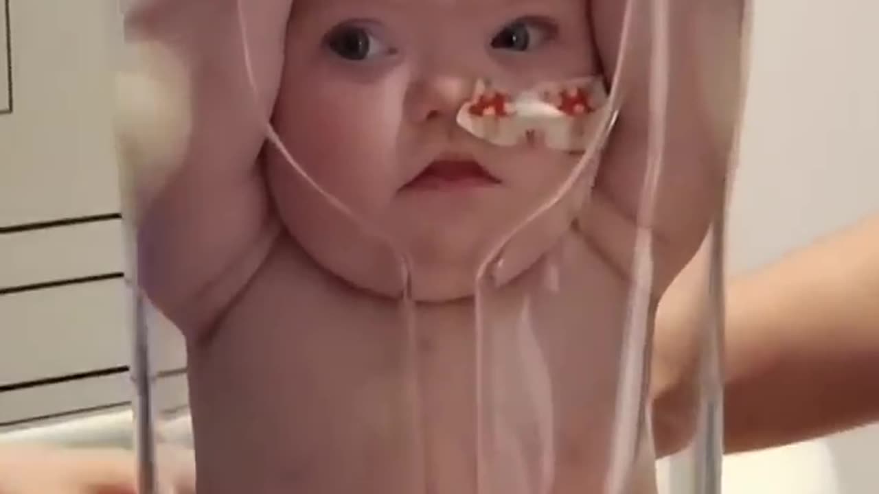 How Baby Get An X-Ray