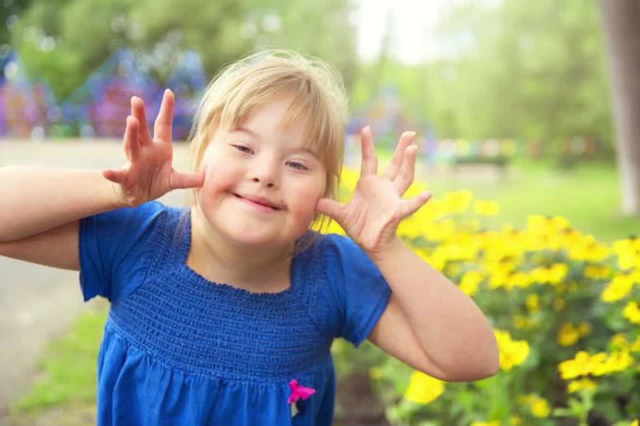 Do you know what is Down syndrome