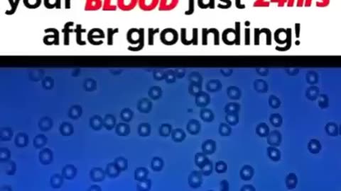 🔴 GROUNDING TO EARTH STOPS BLOODCLOTS - INFLAMMATION & PAIN