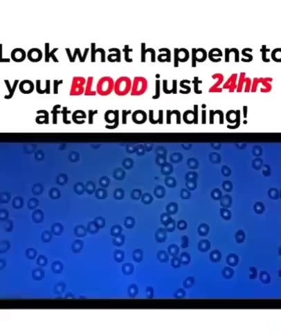🔴 GROUNDING TO EARTH STOPS BLOODCLOTS - INFLAMMATION & PAIN