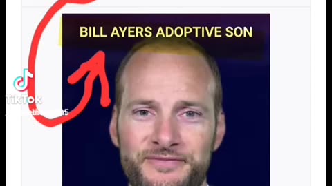 WHY DO KENNEDYS SUPPORT OBAMA