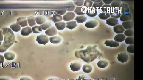 How the Blood Behaves In A Vaccinated Person