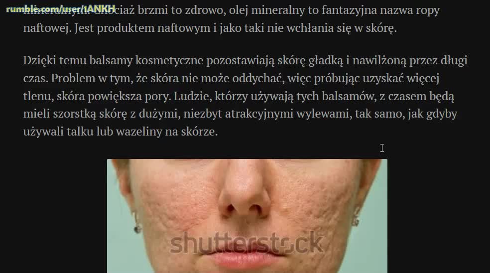 Ochrona i pielęgnacja skóry. Nie stosuj balsamów, tylko olej kokosowy!