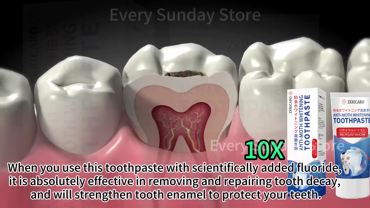 Tooth Decay Tooth Repair solution For tooth Health and repair. link in description!