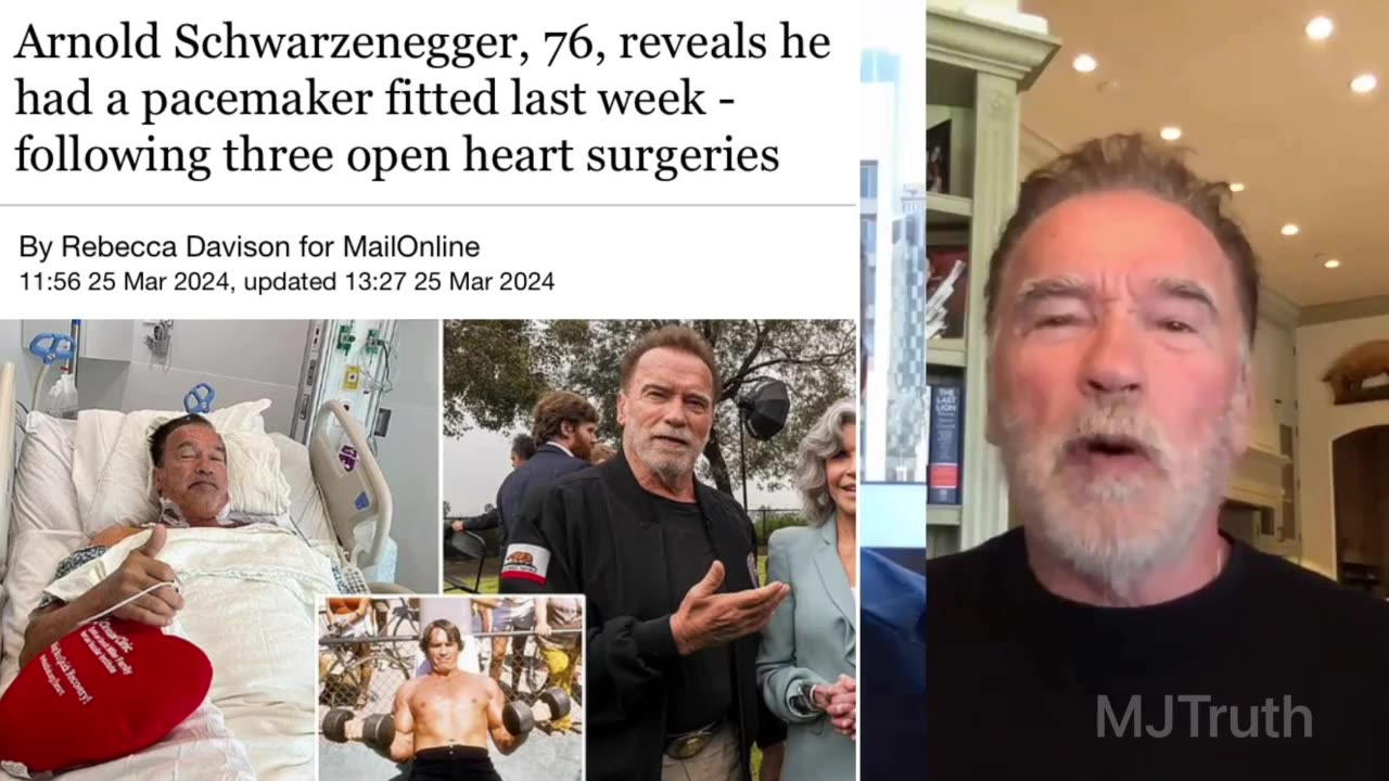 Arnold Schwarzenegger now has a Pacemaker and had Three Open Heart Surgeries