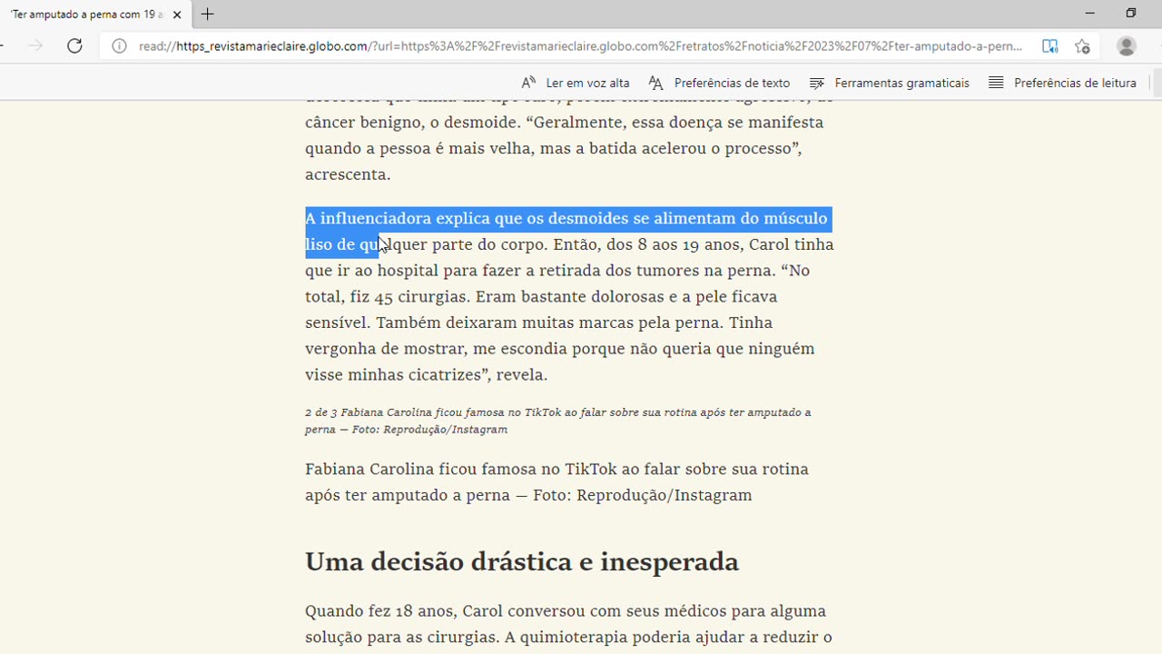 ‘Ter amputado a perna com 19 anos foi a melhor decisão que eu tomei na vida’