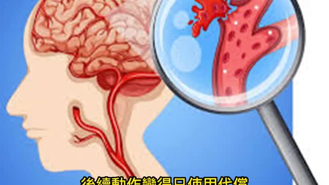 腦中風復健 光靠電療刺激沒用！