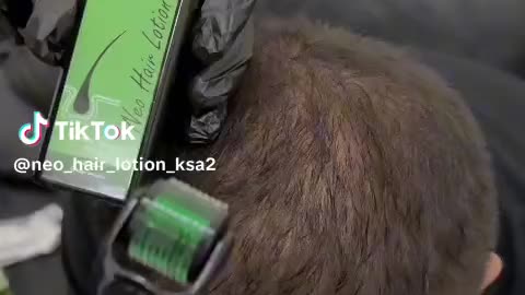 Stop hair fall