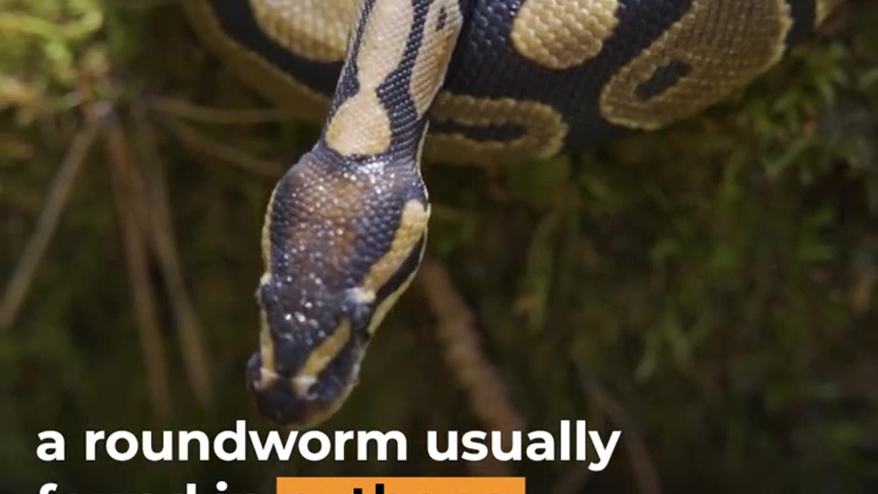 Doctors find live worm in Australian woman's brain | Al Jazeera Newsfeed