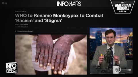 Monkeypox Being Renamed By The World Health Organization To Combat Racism Due To 'Expert' Input