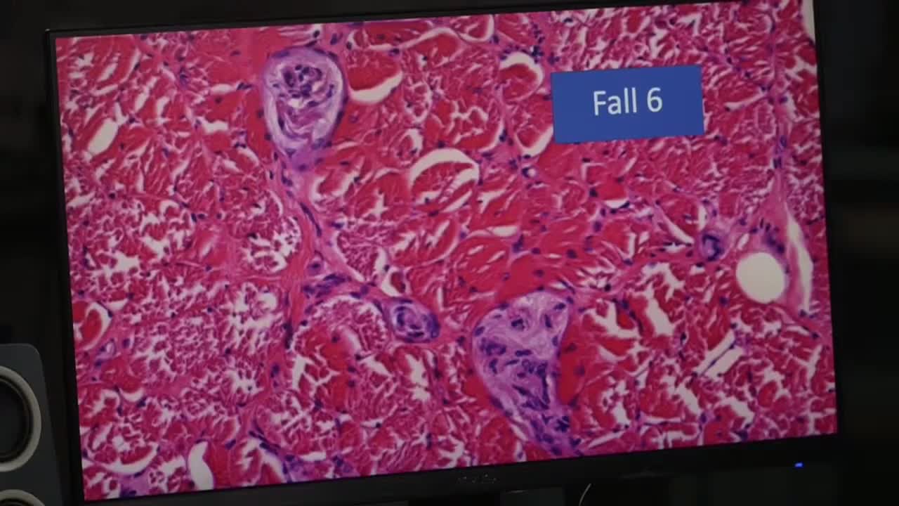 European Scientists View Vaccines under Microscope