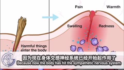 這一部我在2、3個月前就看過的影片，一直存疑。當開始看到身邊有人打加強針後隔日呼吸不上來送急診而柳葉刀也發報導(看下文)，我知道不能再為了怕讓已打針者擔憂而不上傳，請不要打了