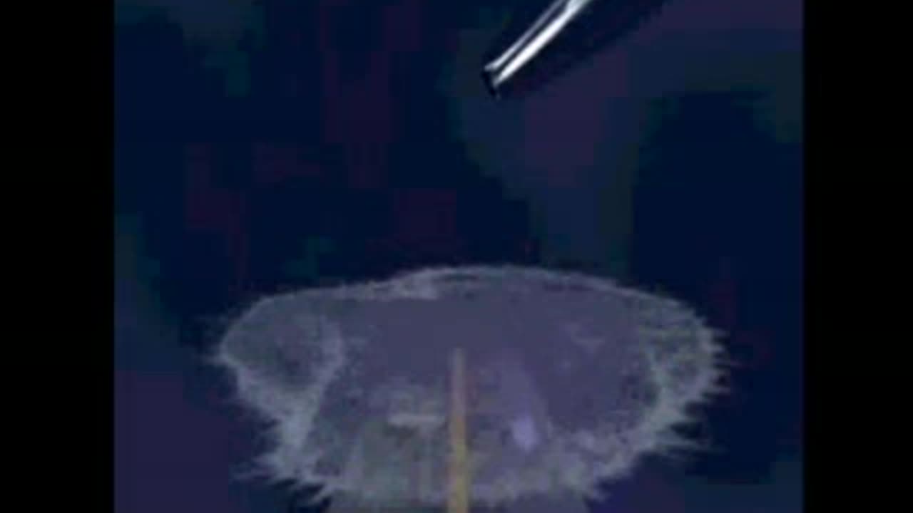 Illustration of Mercury Damage - Univ. of Calgary