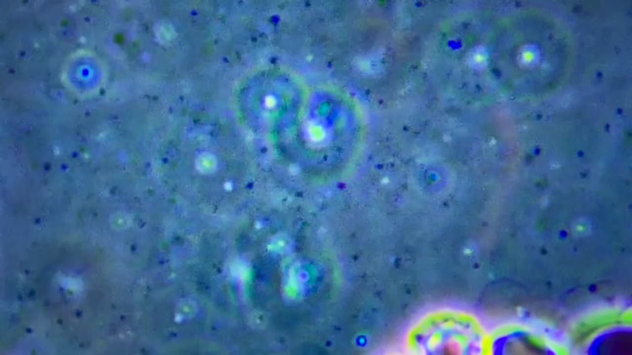 Super Quick update on KAMS 419 hours after slide preparation