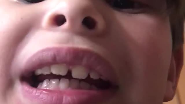 Jacob loses a tooth