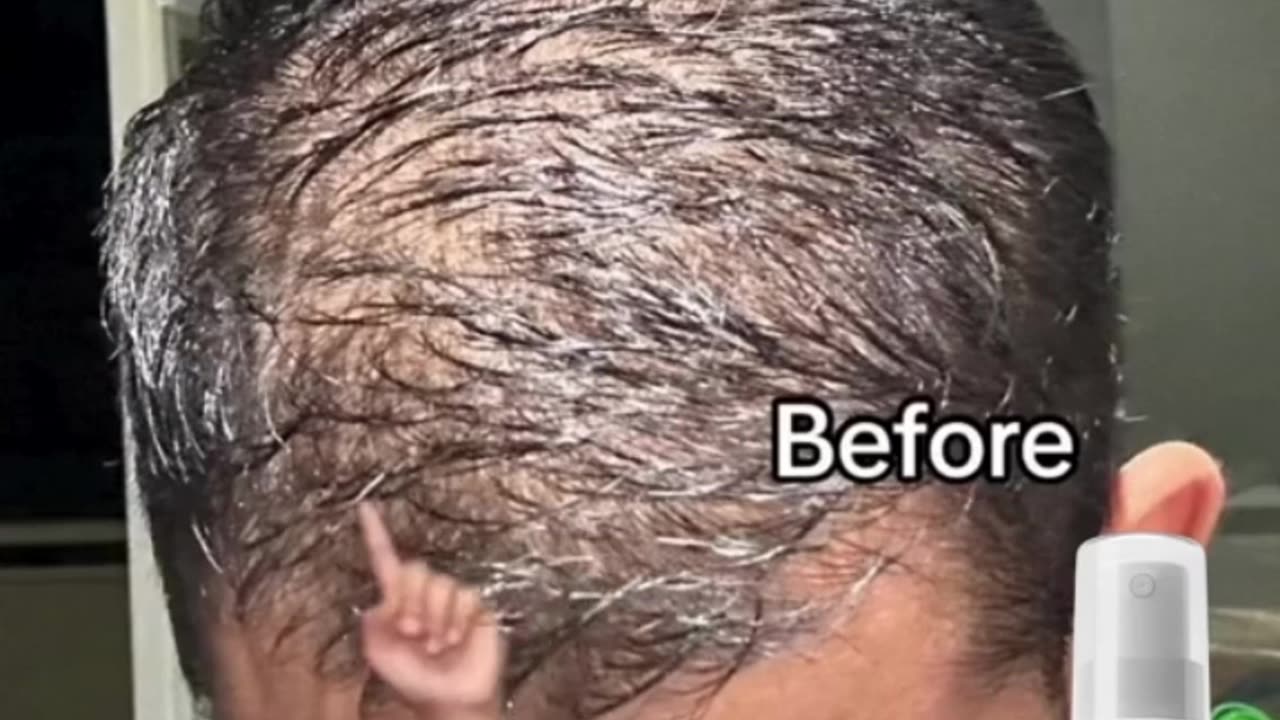 "Say Goodbye to Thinning Hair with FEG!"