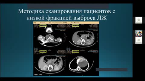 Заседание №179 в записи