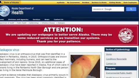 Mary Greeley News - ⚠ ALERT First Dearth From Alaskapox Virus In Southcentral Alaska