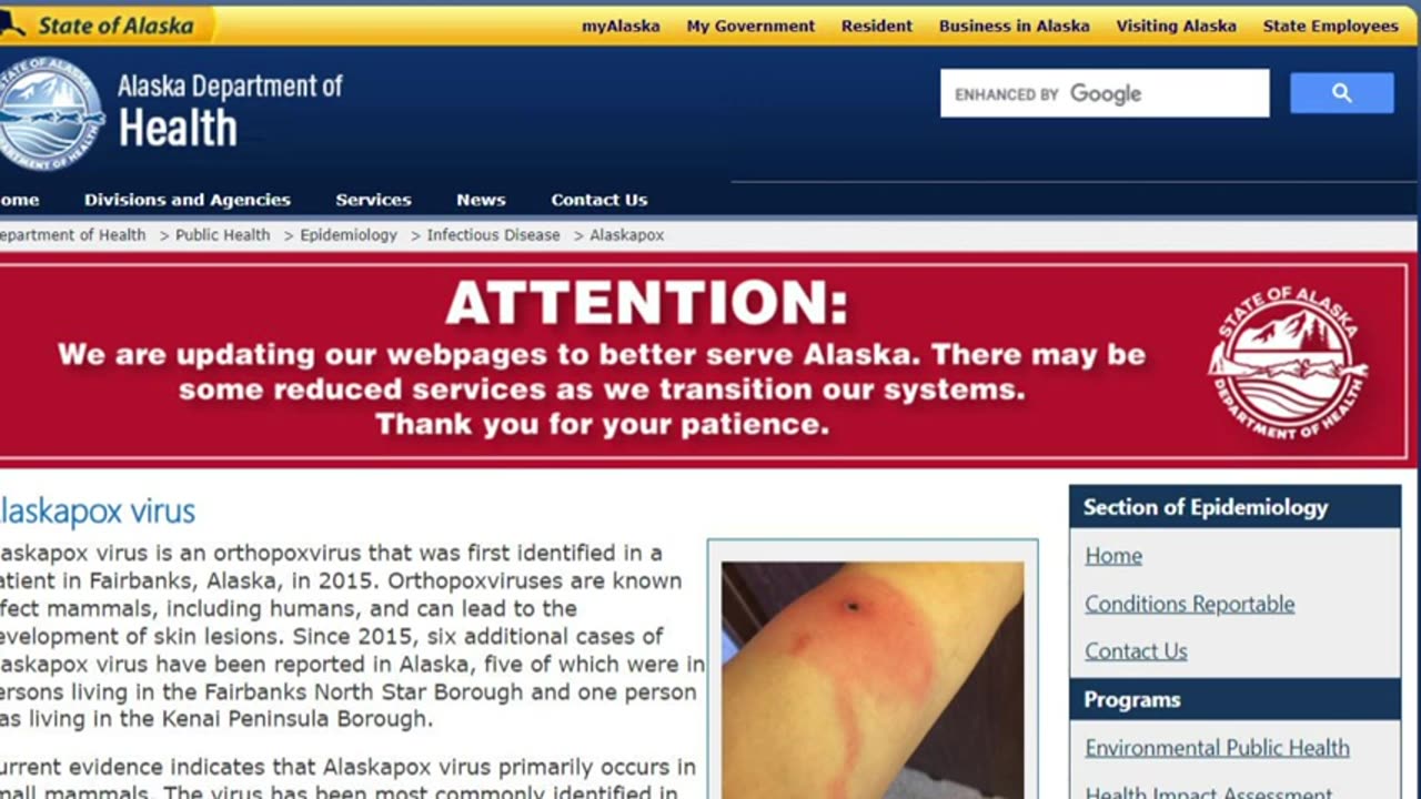 Mary Greeley News - ⚠ ALERT First Dearth From Alaskapox Virus In Southcentral Alaska