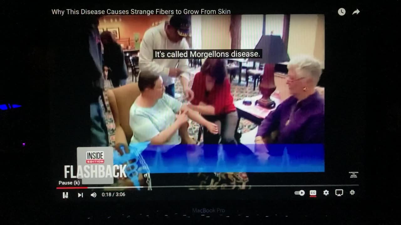 Morgellons unknown, unburnable material