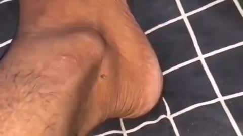 KILLING MOSCUITO FUNNY VIDEOS