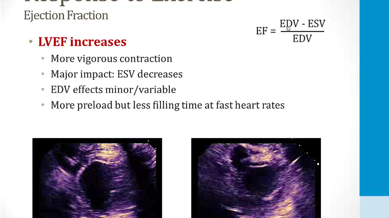 Cardiology - 1. Anatomy and Physiology - 3.CV Response to Exercise
