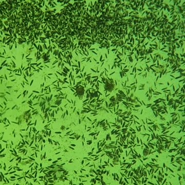 This is why you should stop drinking beer.