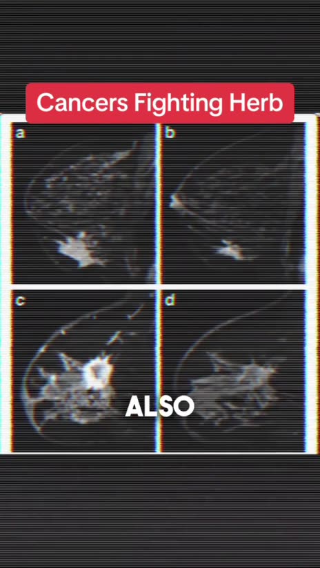 A healthy natural cure for brain cancer & other kinds of cancer