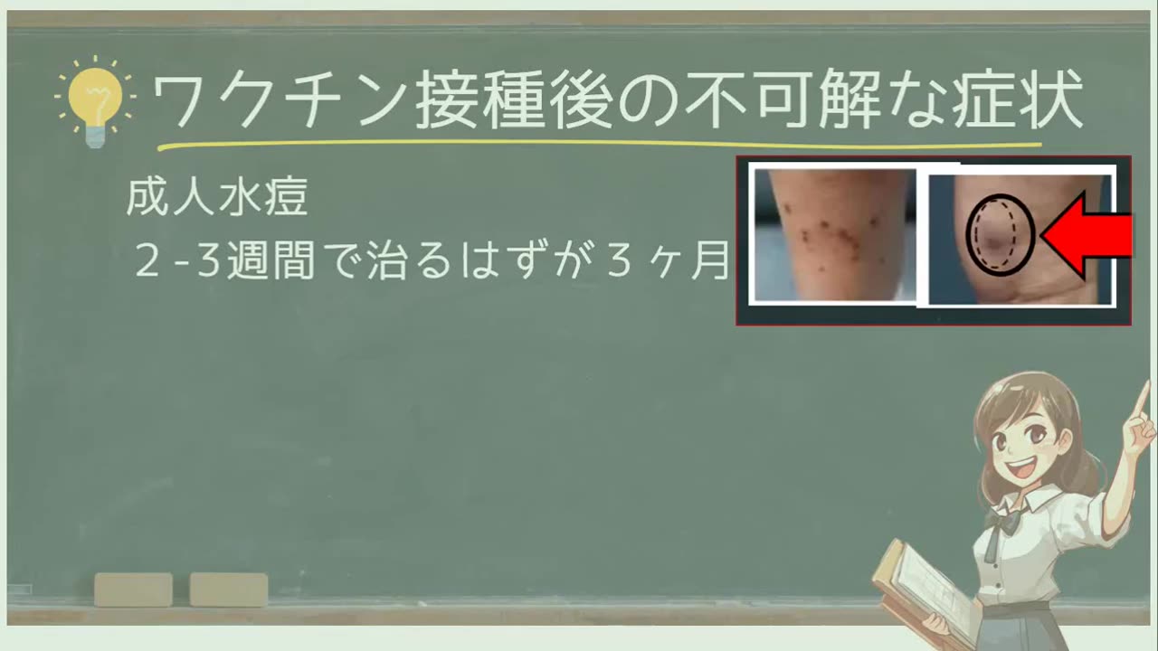 @corowaku_memo ワクチン接種後の不可解な症状