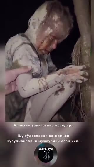 Burned, Shattered Boy in Gaza After Israeli Bombing, Oct. 18, 2023